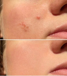 Lumenoraskin Facial Cleansing Brush™