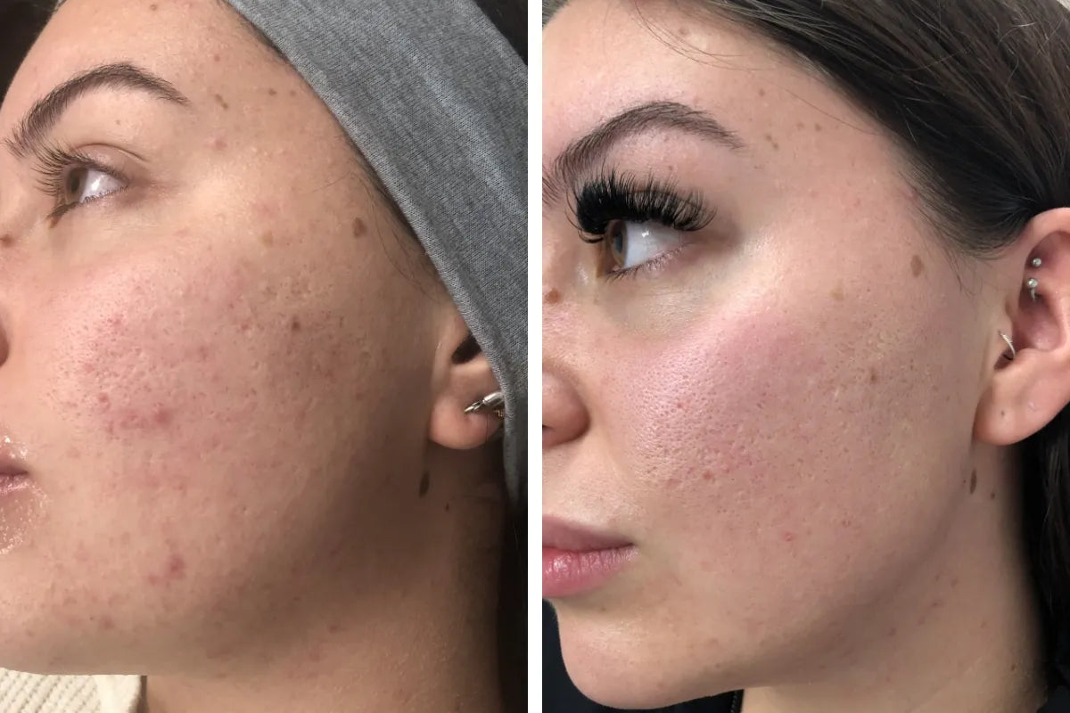 Lumenoraskin Facial Cleansing Brush™