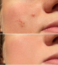 Lumenoraskin Facial Cleansing Brush™