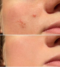 Lumenoraskin Facial Cleansing Brush™