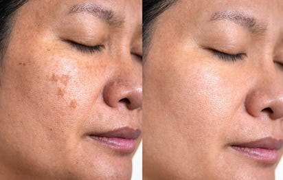Lumenoraskin Facial Cleansing Brush™